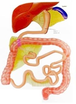 CIRURGIA SLEEVE